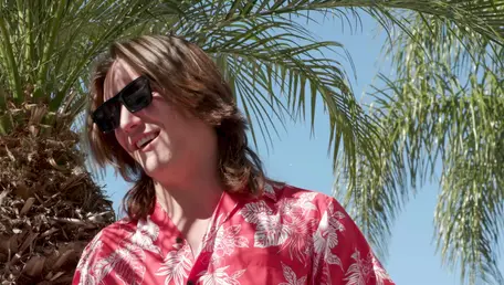 Out Of The Family: Axel's Sunburn Surprise